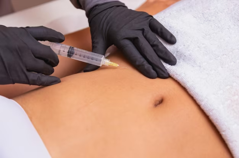 stretch mark microneedling