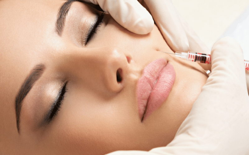 dermal filler london