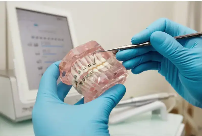 all-on-x dental implants pembroke pines