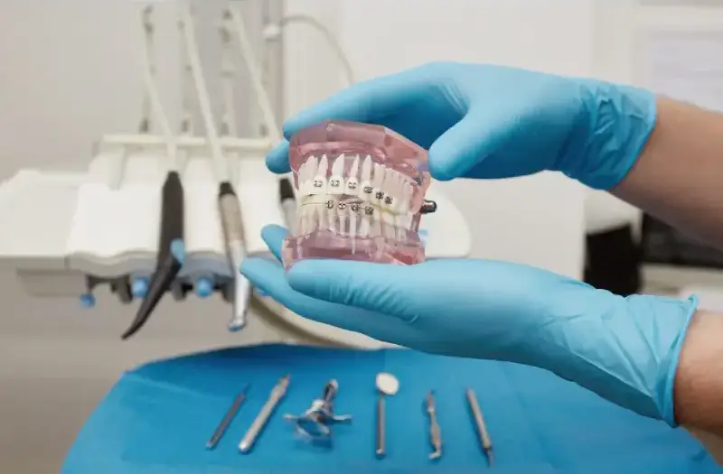 all-on-x dental implants pembroke pines