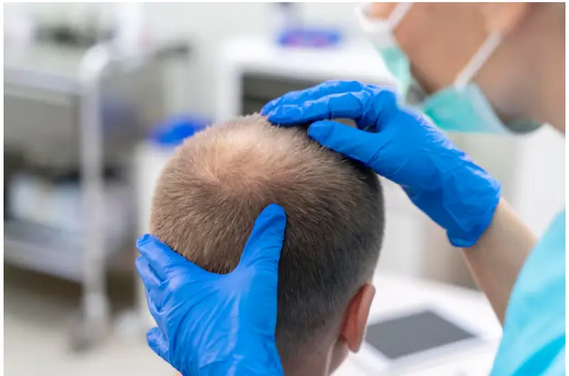Hair Transplant in Istanbul